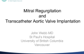 Mitral Regurgitation