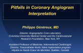 Coronary Angiography II: Artifacts and Pitfalls