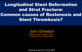 Longitudinal Stent Deformation and Strut Fracture: Common Causes of Restenosis and Stent Thrombosis?