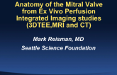 Anatomy of the Mitral Valve: Appreciation from Ex Vivo Perfusion Integrated Imaging Studies (3DTEE, MRI and CT)