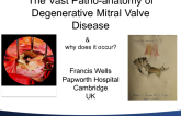 The Vast Pathoanatomy of Degenerative MR