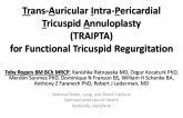 TCT-127. Trans-Auricular Intra-Pericardial Tricuspid Annuloplasty (TRAIPTA)