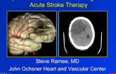 Update on Cardiologist's Role in Acute Stroke Therapy
