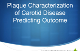 Plaque Characterization of Carotid Disease to Predict Outcomes and Direct Care
