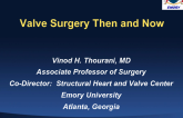 Valve Surgery, Then and Now