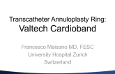 Transcatheter Annuloplasty Ring: Valtech Cardioband