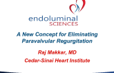 Endoluminal Sciences: A New Concept for Eliminating Paravalvular Regurgitation