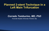 Planned 2-stent Technique in a Left Main Trifurcation