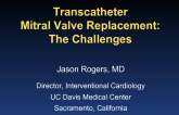 Transcatheter Mitral Valve Replacement: The Challenges