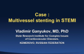 Case Presentation: Multivessel Primary PCI Intervention