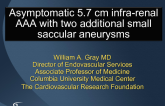 Case 3: Asymptomatic 6.7 cm Infrarenal AAA with Two Additional Small Saccular Abdominal Aortic Aneurysms in a 70-Year-Old Former Smoker