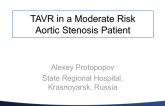 Case Presentation: TAVR in a Moderate Risk Aortic Stenosis Patient