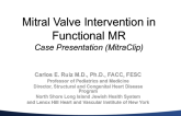 Case Presentation: Mitral Valve Intervention in Functional MR