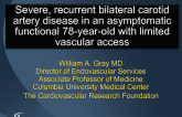 Case 4: Severe Recurrent Bilateral Carotid Artery Disease in an Asymptomatic Functional 78-Year-Old Female with Limited Vascular Access