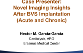 Case Presentation: Novel Imaging Insights After BVS Implantation (Acute and Chronic)