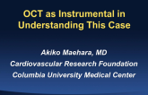 Case Presentation: OCT as Instrumental in Understanding This Case