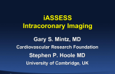 Intravascular Imaging