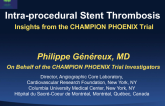 CHAMPION PHOENIX IPST: Implications of Intraprocedural Stent Thrombosis During PCI from a Prospective, Randomized Trial of a Potent Intravenous ADP Antagonist vs. a Standard Ora...