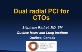 Dual Radial PCI of CTO