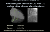 PCI of an Invisible RCA Ostial CTO Assisted By CT