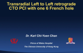 Transradial Left To Left Retrograde CTO PCI with a Single 6 French Access
