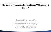 Advanced Surgical Approaches: Robotic Revascularization: When and How?