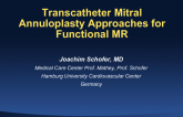 Transcatheter Mitral Annuloplasty Approaches for Functional MR