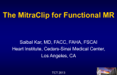 The MitraClip for Functional MR