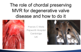 The Role of Chordal Preserving MVR for Degenerative Disease and How to Do It!