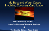 My Best and Worst Cases Involving Coronary Calcification