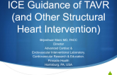 ICE Guidance of TAVR (and Other Structural Heart Intervention)
