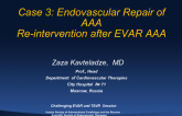 Case #3: Endovascular Repair of Abdominal Aorta Aneurysm