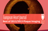 Imaging Coronary Plaques: Best of EHJ