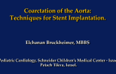 Coarctation of the Aorta: Techniques for Stent Implantation