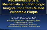 Neoatherosclerosis: Mechanistic and Pathologic Insights into Stent-Related Vulnerable Plaque