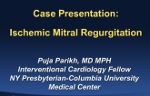 Case Presentation: Ischemic MR