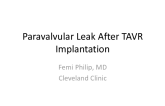 Case Presentation: Paravalvular AR After TAVR