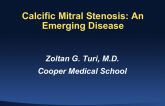 Calcific Mitral Stenosis: An Emerging Disease