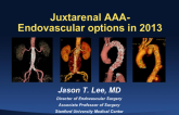 Treatment of Juxtarenal and Pararenal AAA: Endovascular Options in 2013