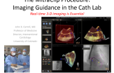 The MitraClip Procedure: Imaging Guidance in the Cath Lab