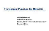 The MitraClip Procedure: Transseptal Puncture