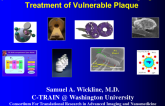 Update on the Potential Application of Focal Nanotherapies for Imaging and Treatment of Vulnerable Plaque
