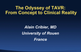 The Odyssey of TAVR: From Concept to Clinical Reality
