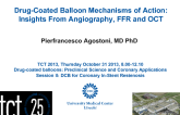 Drug-Coated Balloon Mechanisms of Action: Insights From Angiography, FFR and OCT