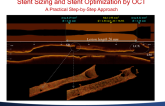 Stent Sizing and Stent Optimization by OCT: A Practical Step-by-Step Approach and Emerging Data About Endpoints and Efficacy