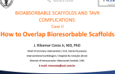Case 2: How to Overlap Bioresorbable Scaffolds