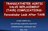 Case 1: Paravalvular Leak After TAVR