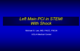 Case #7: Left Main PCI in the Patient Presenting with Cardiogenic Shock