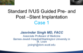 Case I: Standard IVUS Guided Pre- and Post-Stent Implantation
