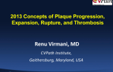 2013 Concepts of Plaque Progression, Expansion, Rupture, and Thrombosis